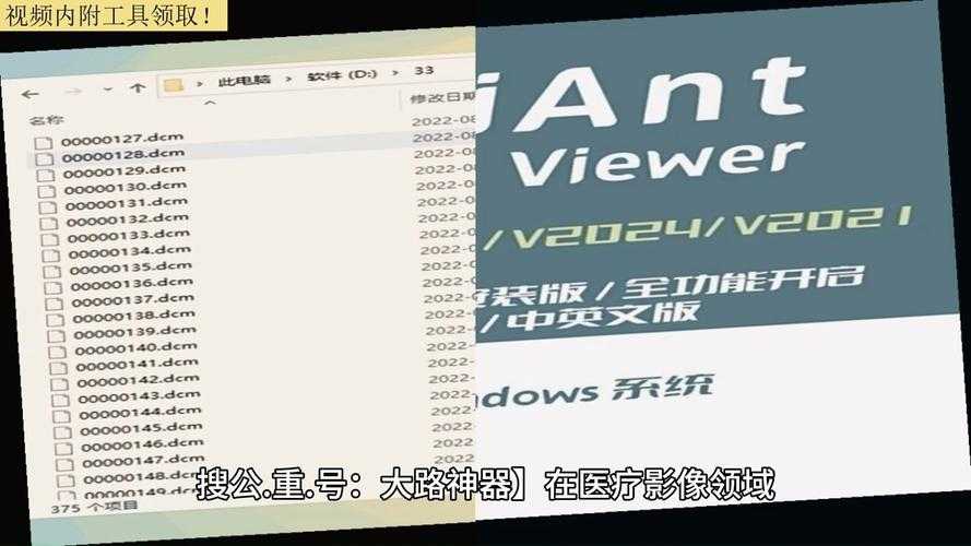 2025年普通人如何轻松打开DCM医学影像文件