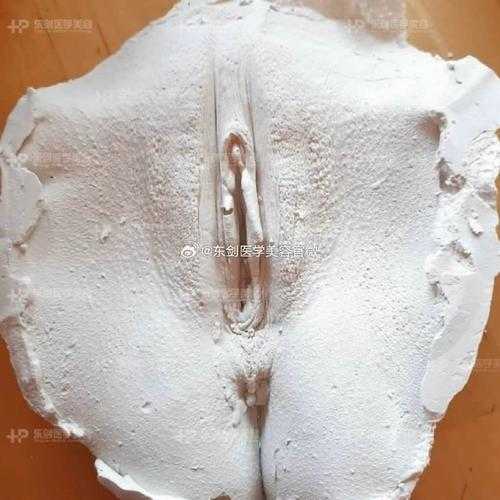 女性私密整形手术真实案例分享